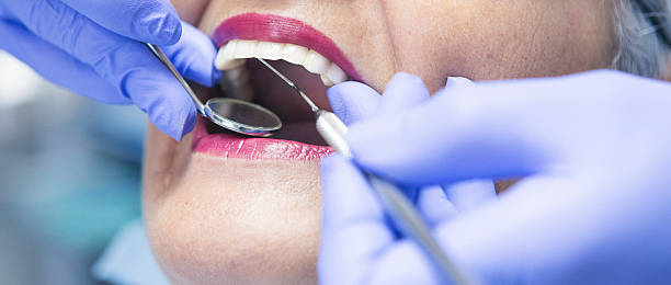 Best Emergency Dentist for Lost Fillings or Crowns in Poydras, LA